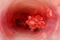 International Conference on Hematology & Blood Disorders International Conference on Hematology & Blood Disorders