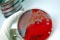 2<sup>nd</sup> International Conference on Clinical Microbiology & Microbial Genomics 2<sup>nd</sup> International Conference on Clinical Microbiology & Microbial Genomics