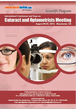 Cataract